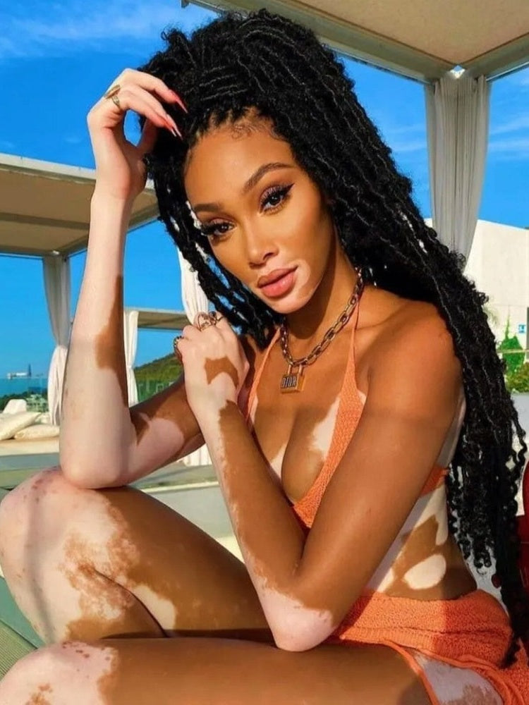 Winnie Harlow 8.5 x 11 Color Photograph Art Print Photo Picture Collectibles:Photographic Images:Photographs Style Your Walls
